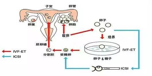 多囊怎么备孕才会怀上 多囊同房还有必要避孕吗